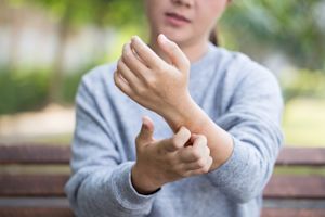 Bij dit weer heb je het meeste last van een droge huid en eczeem