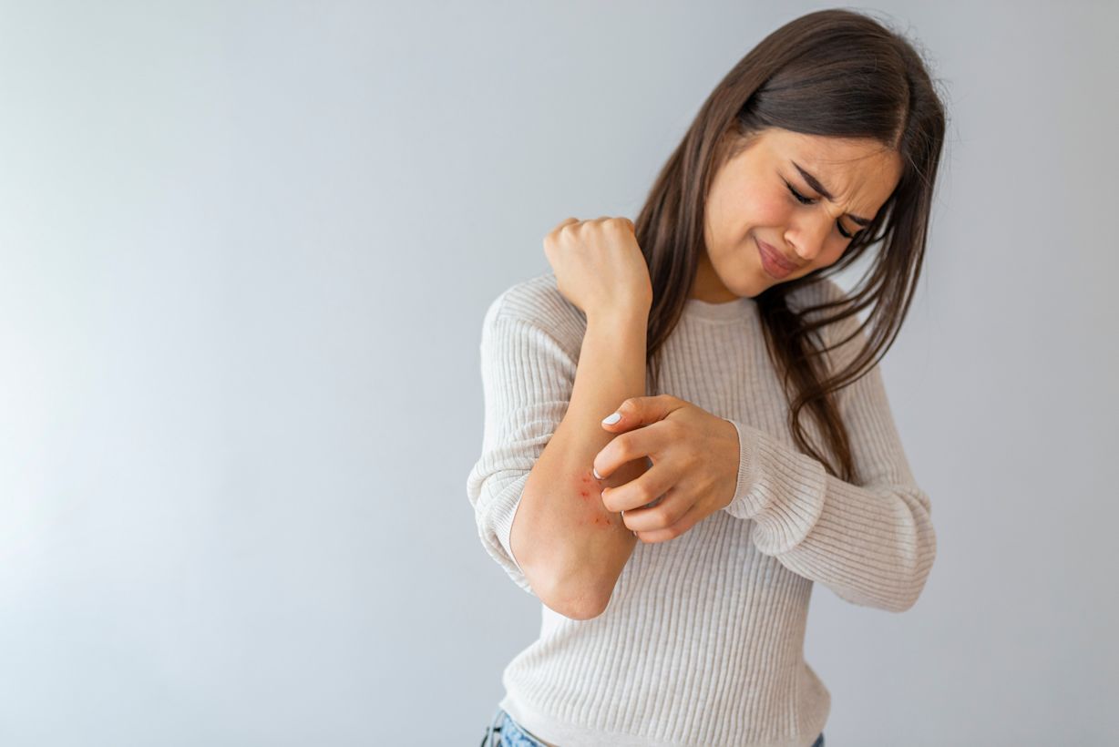 Bij psoriasis heb je vaak last van rode plekken die jeuken of pijn doen. Foto: Adobe Stock / Dragana Gordic.