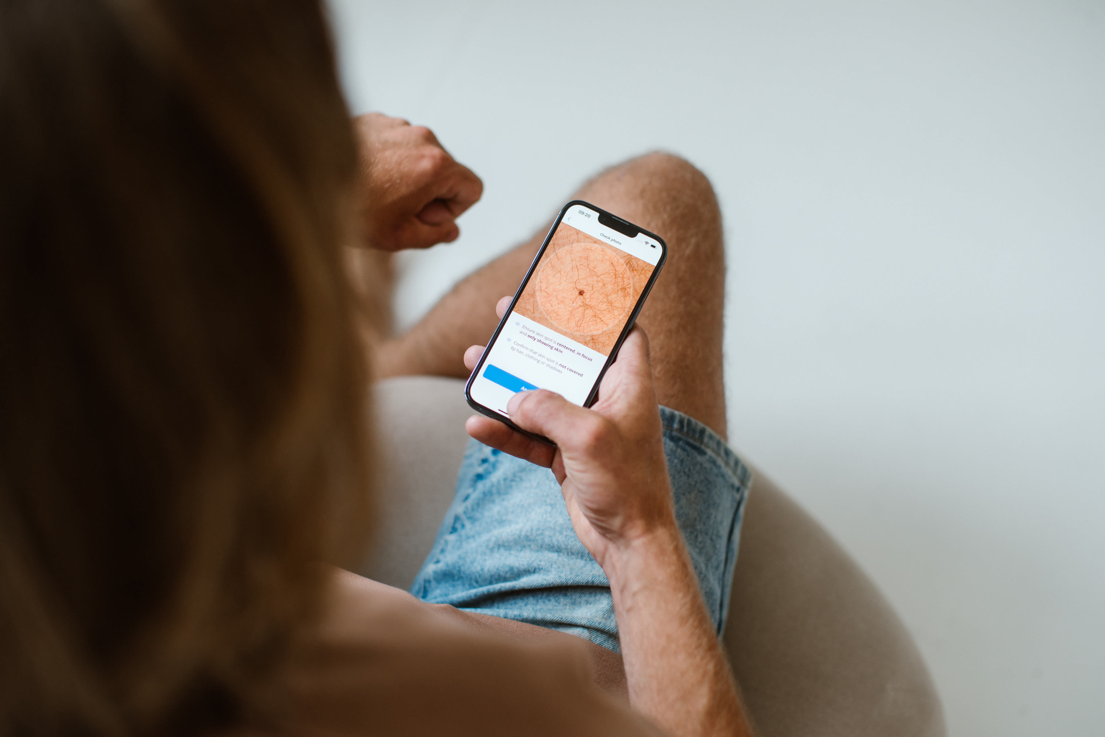 Gebruik van de Skin Vision-app, Zilveren Kruis